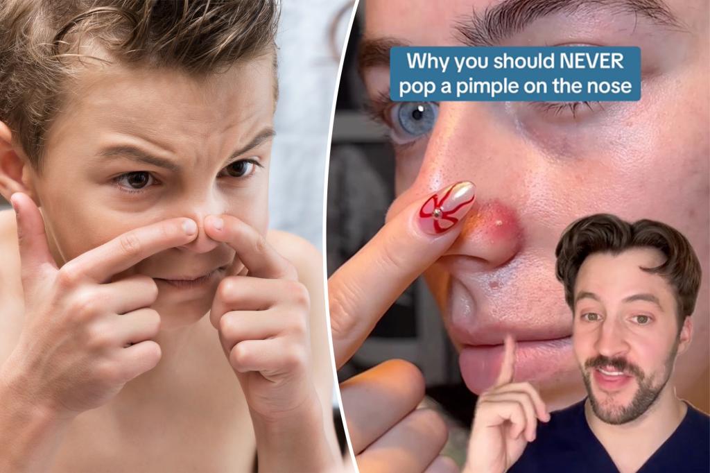 Why you should never pop a pimple in the 'triangle of death'